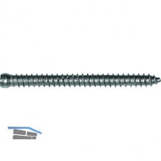 Rahmenanker 7.5x 62 Zylinderkopf 7.5 Torx30 verzinkt dbellose Verschraubung